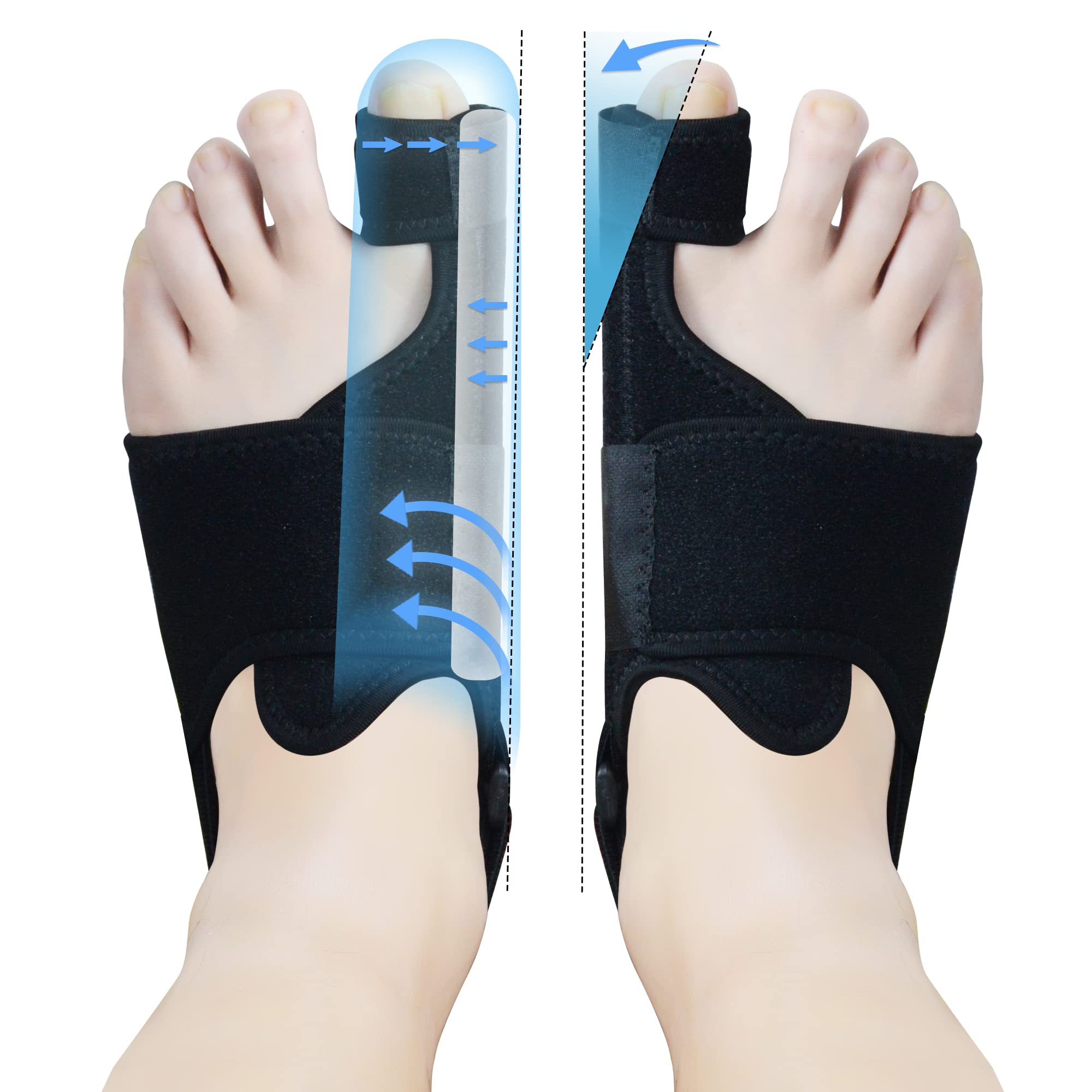 Bunion Corrector Night Splint for Women & Men: Big Toe Straightener, Pain Relief Bunion Brace